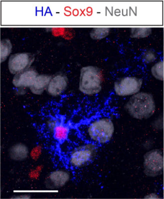 Representative image of astrocyte transduced with AAV, labeled with HA blue) and astrocytemarker (Sox9). Neurons are identified by NeuN staining. Image from publication CC-BY-4.0. PMID:38574730