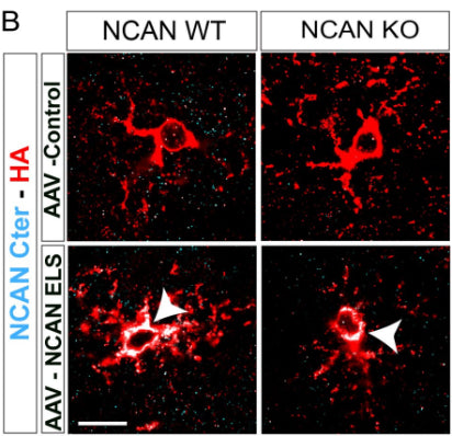 Representative images of astrocytes transduced with AAV Control-HA or AAV NCAN ELS-HA (marked with HA) in red) and NCAN C-terminal in cyan. Image from publication CC-BY-4.0. PMID:38574730