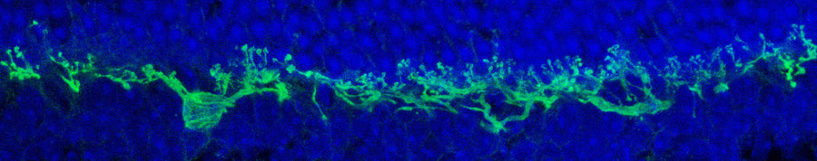 DAPI (blue) was used for DNA staining. The image was kindly provided by Arlene Hirano, University of California, Los Angeles.