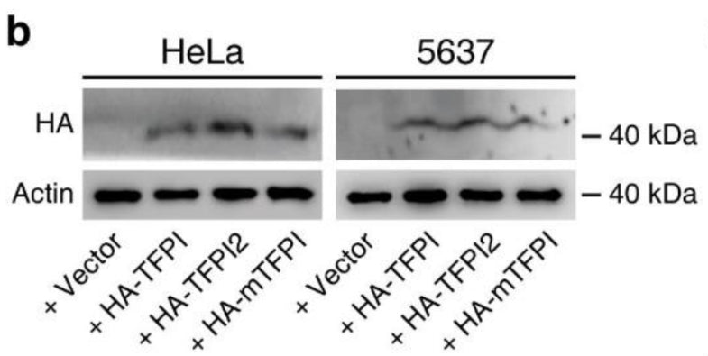 TFPI, TFPI2, and mTFPI were expressed in HeLa or 5637 cells via lentiviral transduction. Expressed exogenous TFPI proteins in cells were confirmed via immunoblot detecting the triple HA tag) fused to their N-termini. Actin was used as a loading control. Image from publication CC-BY-4.0. PMID: 36351897