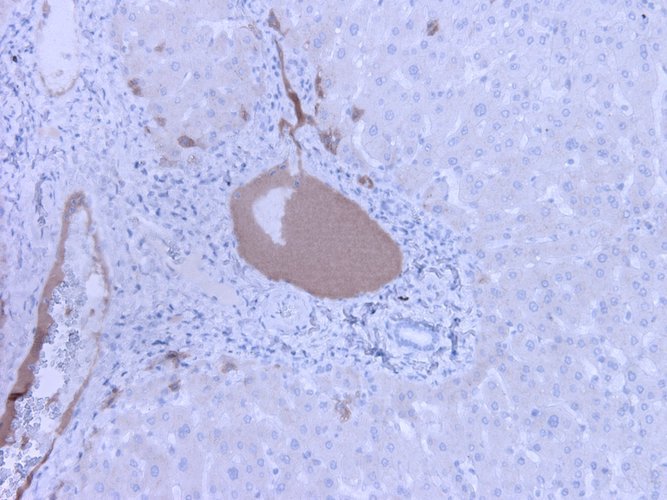 Mouse Anti-Complement C3a/C3a(desArg)/C3