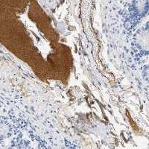 Mouse Anti-Complement Factor H (Beta-1H-Globulin)