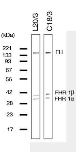 Mouse Anti-Complement Factor H (Beta-1H-Globulin)