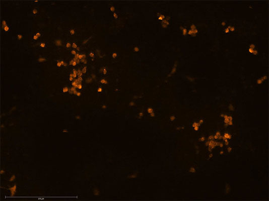 Immunocytochemistry of iPSC-derived microglial cultures labelling Iba1 marker 1:500, red), scale bar = 275 μm. Image kindly provided by Patricia Villegas Zafra, Achucarro Basque Center for Neuroscience.