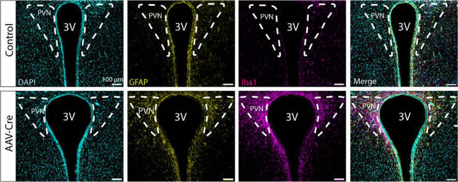 Example comparison of glial fibrillary acidic protein (GFAP) and ionized calcium binding adaptor molecule 1 (Iba1) (1:500) expression in the wild-type paraventricular nucleus of the hypothalamus (PVN) between Control and AAV-Cre mice groups. Image from publication CC-BY-4.0. PMID: 38227343