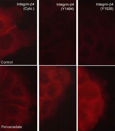 Immunocytochemical labeling of integrin β4 in control (Top) and pervanadate-treated A431 cells (Bottom). The cells were labeled with mouse monoclonal anti-integrin β4 (Cytoplasmic region) (left) or rabbit polyclonals anti-integrin β4 (Tyr-1494) (middle) or anti-integrin β4 (Tyr-1526) (right), then the antibodies were detected using appropriate secondary antibodies conjugated to DyLight® 594.