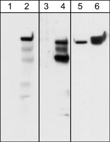 Western blot analysis of A431 cells serum starved overnight (lanes 1, 3, & 5) and treated with pervanadate (1 mM) for 30 min (lanes 2, 4, & 6). The blots were probed with rabbit polyclonal anti-Integrin β4 (Tyr-1526) (lanes 1 & 2) and anti-Integrin β4 (Tyr-1494) (lanes 3 & 4) or with mouse monoclonal anti-Integrin β4 (lanes 5 & 6).