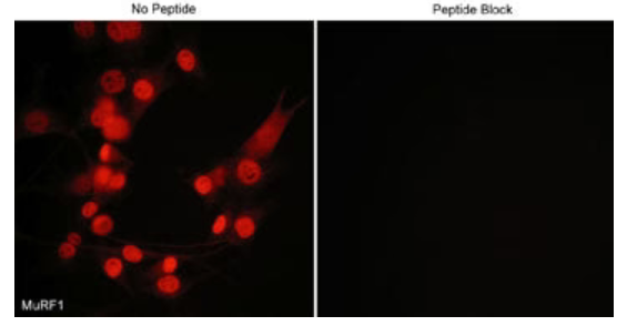 Immunocytochemical labeling of MuRF1 in mouse C2C12 cells. The cells were labeled with rabbit polyclonal MuRF1 antibody, then detected using appropriate secondary antibody conjugated to Cy3. The antibody was used in the absence (left) or presence (right) of blocking peptide.