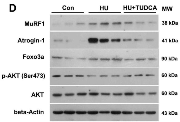 Western blot analysis of MuRF1, Atrogin-1, FoxO3a, p-AKT (Ser473), and total AKT in the soleus muscle of control, HU, and HU+TUDCA mice. Image from publication CC-BY-4.0. PMID: 37525907