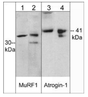 Western blot analysis of mouse heart tissue (lanes 1 & 3) or C2C12 cells (lanes 2 & 4). The blot was probed with anti-MuRF1 (C-terminal region) (lanes 1 & 2) or anti-Atrogin-1 (lanes 3 & 4).