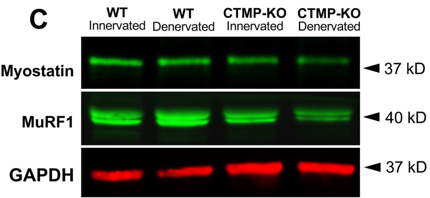 Markers for muscle degeneration, Myostatin and MuRF-1 (1:1000), were significantly less expressed in CTMP-KO gastrocnemius muscle compared to WT mice. Image from publication CC-BY-4.0. PMID: 36652767