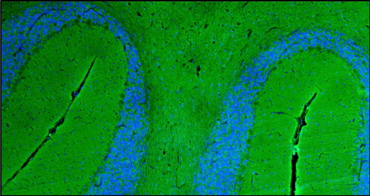 Representative section of formalin fixed, paraffin-embedded rat brain cerebellum region showing staining of NCAM1. The sections were stained with anti-NCAM1 chicken polyclonal antibody (visualized in green) at 1 µg/mL (1:200) dilution. DAPI nuclear stain (blue) shows cell nuclei. Magnification 100X.