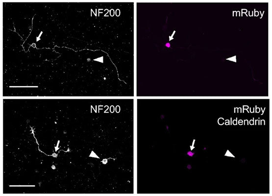 Confocal micrographs of caldendrin KO cultures infected with AAV-mRuby (top) or AAV-mRuby-caldendrin (bottom) showing immunolabeling for NF200 (1:1000, left) and mRuby (right). NF200-positive DRGNs with and without mRuby fluorescence are indicated by arrows and arrowheads, respectively. Scale bar, 100 µm. Image from publication CC-BY-4.0. PMID:36788334