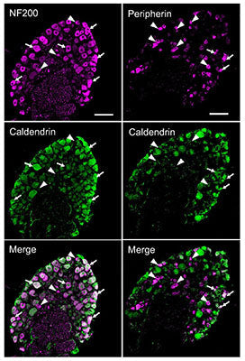 Confocal micrographs of DRG cryosections from WT mouse double-labeled with antibodies against caldendrin (green) and NF200 (1:1000, purple) or peripherin (1:1000, purple). Arrows and arrowheads indicate cells in which caldendrin is or is not, respectively, co-localized with NF200 or peripherin. Results are representative of at least 3 independent experiments. Scale bar, 100 µm. Image from publication CC-BY-4.0. PMID:36788334