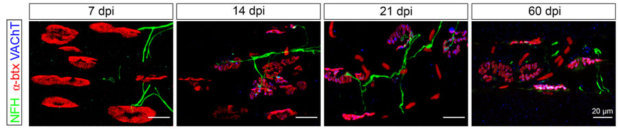 Representative images of sections of a rat G muscle 7, 14, 21, and 60 dpi, immunostained against NFH (1:200; green), α-btx (red), and VAChT (blue), respectively, to label axons, neuromuscular junctions, and the synaptic vesicle-filled motor end plate. Larger numbers of reinnervated NMJs were observed with increased time after injury, with almost complete innervation at 60 dpi. The nicotinic receptor field expands after early denervation. Image from publication CC-BY-4.0. PMID: 36759186