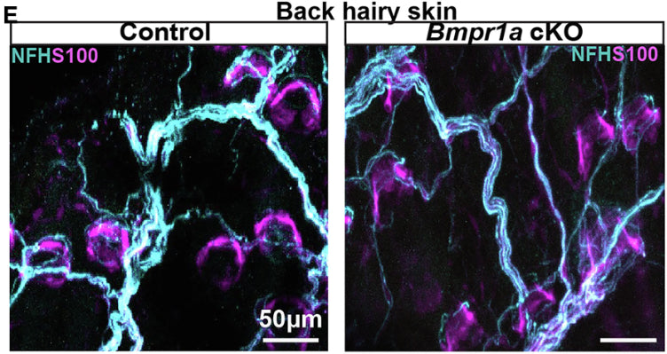 Example images of back hairy skin wholemount staining of NFH (1:500) and S100B in control and mutant mice. Overall innervation and lanceolate ending morphologyImage from publication CC-BY-4.0. PMID:37607547