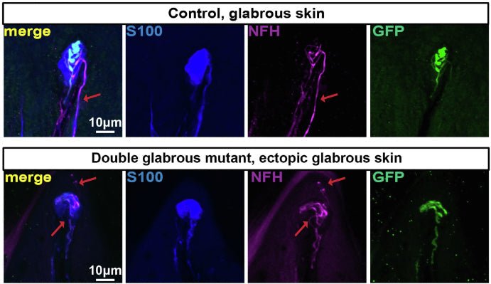 Forelimb pedal pad sections of control Npy2r-GFP glabrous skin (top) and Prx1Cre; Lmx1bfl/fl; Npy2r-GFP double glabrous mutant, ectopic glabrous skin (bottom). The sections are stained using S100, GFP, and NFH (1:500). Red arrows point to the GFP- axon (presumably Ret+).Image from publication CC-BY-4.0. PMID:37607547