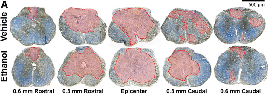 Representative images of mouse spinal cord throughout the rostral-caudal extent of injury 42 days after spinal cord injury (SCI). Sections are stained for myelin (blue, erichrome cyanine) and axons (brown, neurofilament, 1:1500). Frank lesion areas are highlighted in red. Spared tissue is evident by both blue and brown staining. Image from publication CC-BY-4.0. PMID:37350129
