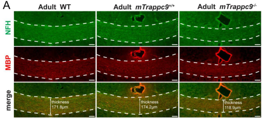 NFH (axonal tracts,) and MBP (myelin) immunostaining of the corpus callosum sections. Compared with WT (C57BL/6 wildtype) and mTrappc9+/+, the corpus callosum (highlighted with white dotted lines) of mTrappc9m/m mice was significantly thinner. Image from publication CC-BY-4.0. PMID:37416774