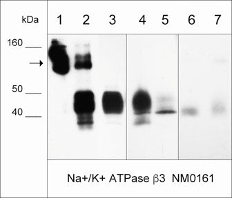 Western blot of immunoprecipitates (IP) and whole lysates. The antibody only (lane 1), IP from A431 cell lysate (lane 2), A431 cell input (lane 3), LNCaP cells (lane 4), MeWo cells (lane 5), and normal human lung (lane 6) and skin (lane 7). The blot was probed with anti-Na+/K+ ATPase β3 (lanes 1-7). The arrow designates native antibody, while the β3 subunit migrates around 40 kDa.