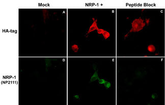 Immunocytochemical double labeling using anti-HA mouse monoclonal and anti-NRP-1 rabbit polyclonal antibodies in COS-7 cells mock transfected (A,D) or transfected with NRP-1 constructs (B,E). The specificity of the binding in E was demonstrated by using NRP-1 peptide in the presence of the anti-NRP-1 antibody (C,F).