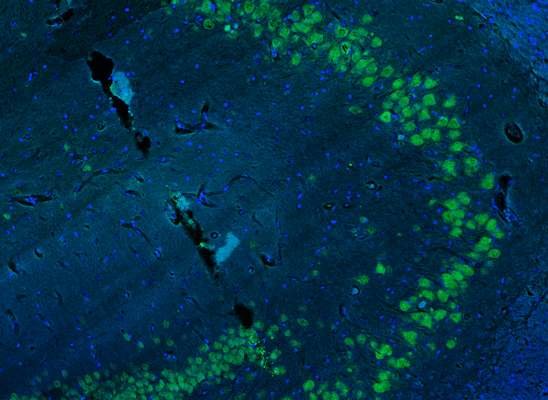 Representative section of formalin fixed, paraffin-embedded rat brain hippocampus region showing cells stained by anti-NeuN (Rbfox3) antibody. DAPI nuclear stain (blue) shows cell nuclei.