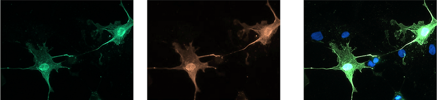 Immunofluoresence of COS-7 cells expressing OLIG2-flag using chicken anti-OLIG2 antibody (green) and rabbit anti-flag antibody (red). Blue is DAPI nuclear stain showing nuclei of both transfected and untransfected cells. Staining shows 100% correspondence between chicken anti-OLIG2 signal and anti-flag in transfected cells.