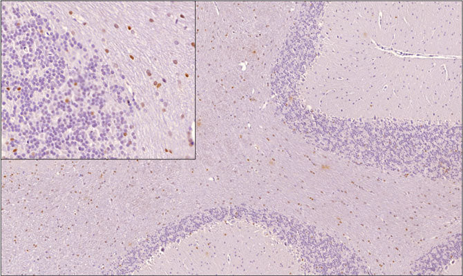 Sagittal section of formalin fixed, paraffin-embedded rat brain showing nuclear staining of OLIG2 positive cells within the white matter of cerebellum as expected. Inset (top left) shows higher magnification.