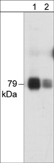 Western blot analysis of PKCθ in human Jurkat cell lysate. The blot was probed with anti-PKCθ at 1:250 (lane 1) and 1:1000 (lane 2).