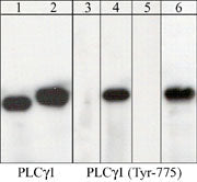 Western blot analysis of PLCγ1 immunoprecipitates from human jurkat cells untreated (lanes 1 & 3) or treated with pervanadate (1 mM) for 30 min (lanes 2,4,5,6). Immunoprecipitation was performed with anti-PLCγ1. The blots were probed with anti-PLCγ1 (lanes 1 & 2) and anti-PLCγ1 (Tyr-775) (lanes 3-6). The latter antibody was used in the presence of phospho- PLCγ1 (Tyr-775) peptide (lane 5), or unrelated phosphotyrosine peptide (lane 6).