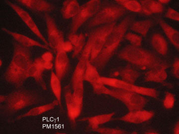 Immunocytochemical labeling of PLCγ1 in adelhyde-fixed and NP-40 permeabilized human MDA-MB-231 breast carcinoma cells. The cells were labeled with mouse monoclonal anti-PLCγ1 antibody. The antibody was detected using appropriate secondary antibody conjugated to DyLight® 594.