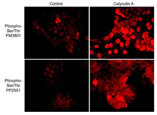 Immunocytochemical labeling of phosphoserine and phosphothreonine in control and calyculin A-treated A431 cells. The cells were labeled with mouse monoclonal anti-Phosphoserine/threonine and rabbit polyclonal anti-Phosphoserine/threonine, then the antibodies were detected using appropriate secondary antibodies conjugated to Cy3.