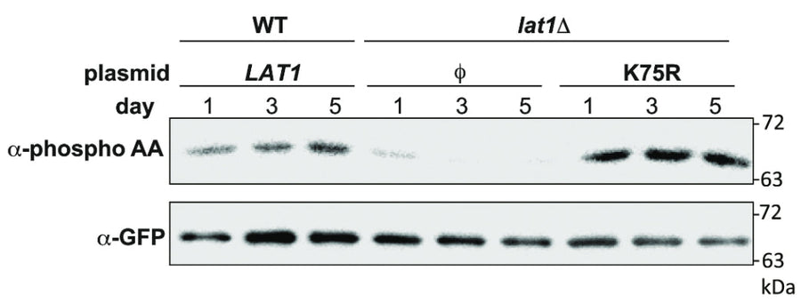 Mutant lat1Δ cells expressing the indicated plasmids, as well as Mdh1-GFP, were grown in SL medium for the indicated amounts of time, and protein extracts were generated and immunoprecipitated with with α-GFP antibody. Phosphorylation of Mdh1-GFP was detected using α-phosphoamino acid antibody, and total GFP signal in the immunoprecipitate was observed by immunoblotting with the α-GFP antibody. ϕ denotes an empty vector. Image from publication CC-BY-4.0. PMID: 37454238
