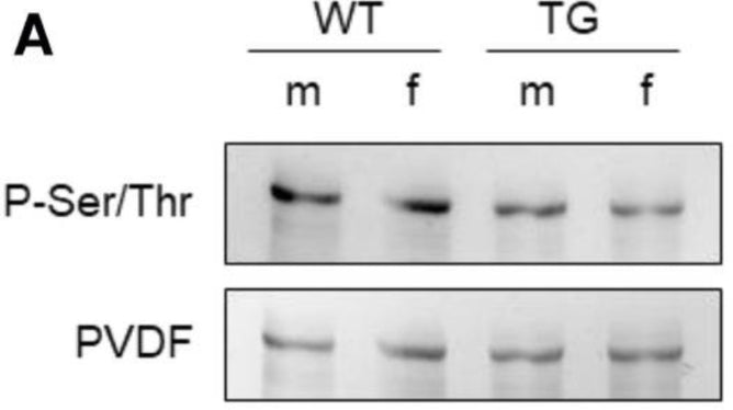 Western blot showing N2B-Titin total phosphorylation (1:500) in male and female mRen2 and WT rats. Image from publication CC-BY-4.0. PMID: 37363100