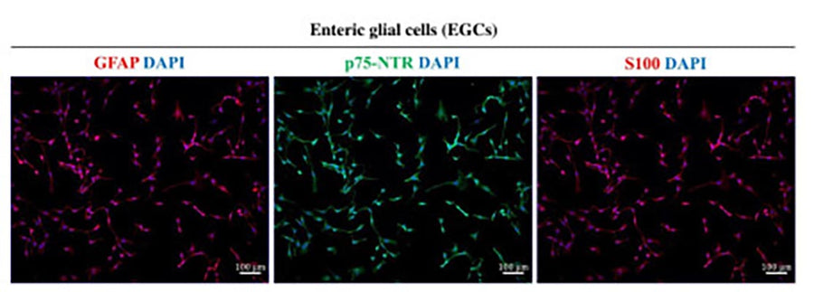 Characterization of mouse vagus nerve derived Schwann cells (VNSCs). The identity and purity of SCs were confirmed using IF staining of S100 (pink), p75NTR (green), and Mpz (1:1000, red) under a fluorescent microscope (ZEISS Apotome 2). The purity of the cultured SCs (99%) was analyzed by double positive staining of DAPI with S100/p75NTR/Mpz markers. Each image represents 3 images from 3 independent experiments. Scale bar: 50 μm, n = 3. Image from publication CC-BY-4.0. PMID: 37127673