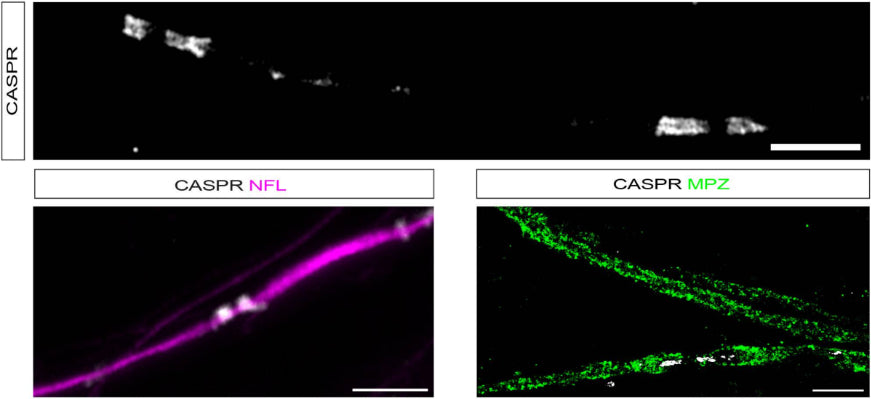 In mature myelinating cultures, SCs CASPR 1:500; white) can be detected in the characteristic staining pattern marking paranodes. Scale bar 5 μm. Paranodal CASPR co-localised on NFL-labelled axons (magenta). Scale bar: 5 μm. When colabelling with MPZ (1:500; green), CASPR is localised to paranodal loops adjacent to a node of Ranvier. Scale bar: 10 μm. Image from publication CC-BY-4.0. PMID:37642648