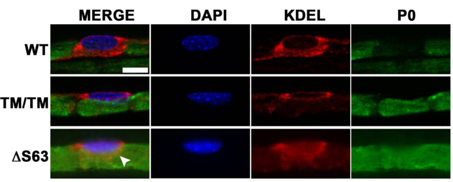 Representative immunofluorescence images of mouse sciatic nerve teased fibers at postnatal day 30. Fibers were stained for P0 (green), endoplasmic reticulum (ER) (KDEL, red), and DAPI (blue). Image from publication CC-BY-4.0. PMID: 36350884
