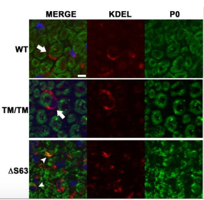 Representative immunofluorescence images of mouse sciatic nerve cross sections at 2 months of age. Cross sections were stained for P0 (green), endoplasmic reticulum (ER) (KDEL, red), and DAPI (blue). Image from publication CC-BY-4.0. PMID: 36350884