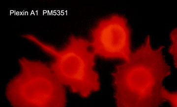 Immunocytochemical labeling of Plexin A1 in aldehyde fixed and NP-40 permeabilized human NCI-H1299 lung carcinoma cells. The cells were labeled with mouse monoclonal anti-Plexin A1. The antibody was detected using goat anti-mouse DyLight® 594.
