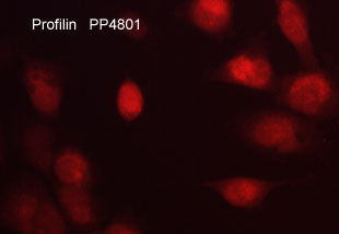 Immunocytochemical labeling of Profilin in aldehyde-fixed and NP-40 permeabilized human NCI-H1915 lung carcinoma cells. The cells were labeled with rabbit polyclonal anti-Profilin antibody. The antibody was detected using appropriate secondary antibody conjugated to DyLight® 594.