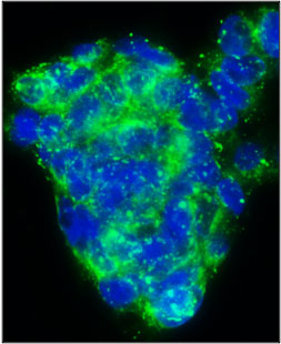 Immunofluorescent staining of HepG2 cells using 5 ug/mL rabbit anti-fibronectin antibody (green). DAPI nuclear stain (blue) shows cell nuclei. Anti-fibronectin stains the membrane of HepG2 cells. ferritin in the cytoplasm of HepG2 cells.