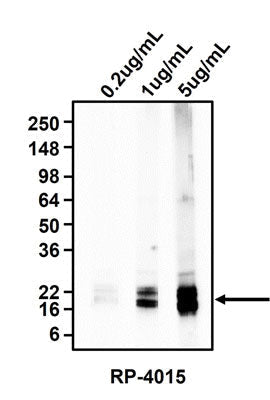 Western blotting of rat brain homogenates using 0.2 ug/mL, 1 ug/mL, or 5 ug/mL rabbit polyclonal anti-Myelin Basic Protein (MBP). rabbit anti-MBP recognizes endogenous MBP at 20 kDa.