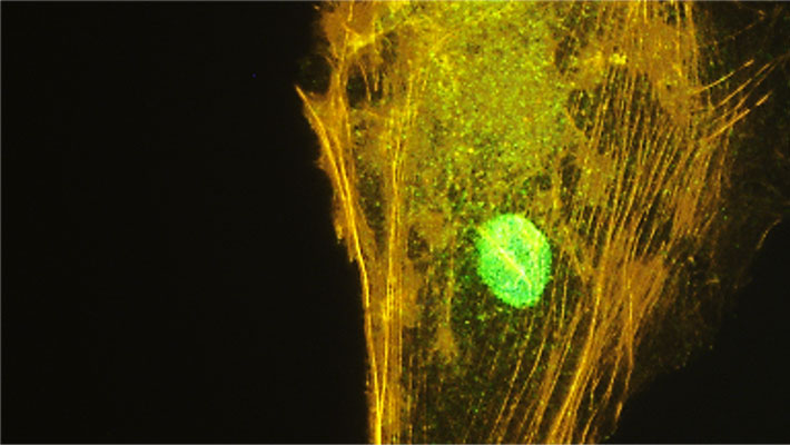 Actin filaments are stained with phalloidin (red).