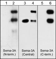 Western blots of neonatal rat brain (lanes 1, 3 & 5) and human recombinant Sema3A/Fc chimera (95/125 kDa) (lanes 2, 4 & 6). Blots were probed with anti-Sema3A (lanes 1 & 2), anti-Sema3A (lanes 3 & 4) and anti-Sema3A (lane 5 & 6). The antibodies recognize both the 95 kDa and 125 kDa forms of the recombinant Sema3A.