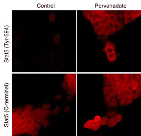Immunocytochemical labeling of Stat5 in control and pervanadate-treated A431 cells. The cells were labeled with mouse monoclonal Stat5 or Stat5 (Tyr-694) antibodies, then the antibodies were detected using appropriate secondary antibody conjugated to DyLight® 594.