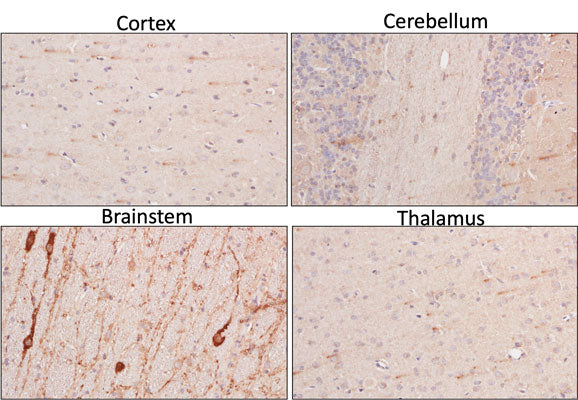 Section of formalin fixed, paraffin-embedded rat brain showing staining of TPH2.
