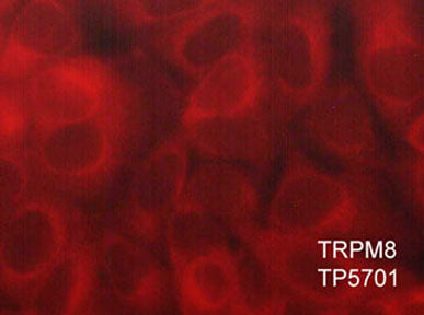 Immunocytochemical labeling of TRPM8 in paraformaldehyde fixed and NP-40 permeabilized MCF-7 cells. The cells were labeled with rabbit polyclonal anti-TRPM8. The antibody was detected using goat anti-rabbit DyLight® 594.