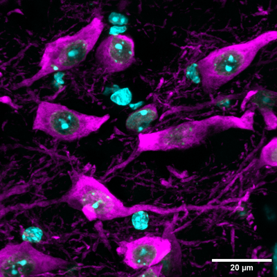 Immunostaining of paraformaldehyde-fixed (4%) free-floating sections (50 µm) of the posterior area of the brain (ventral tegmental area/substania nigra) of an adult mouse brain containing TH+ neurons. TH antibody) dilution @ 1:1500 with secondary detection of the chicken antibody with Alexa-647 anti-chicken IgY, 1:1000. (Image courtesy of Antonella Rios, Duke University.)