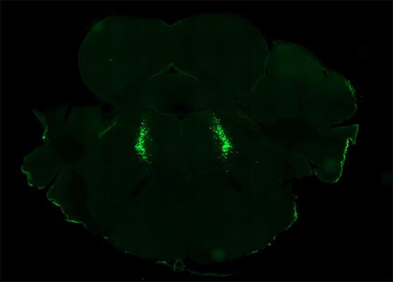 Immunostaining of noradrenergic neurons in the locus coeruleus of a C57BL/6J mouse labeling tyrosine hydroxylase (1:1000, green). Image kindly provided by Dr. Mihwa Choi, UT Southwestern Medical Center.