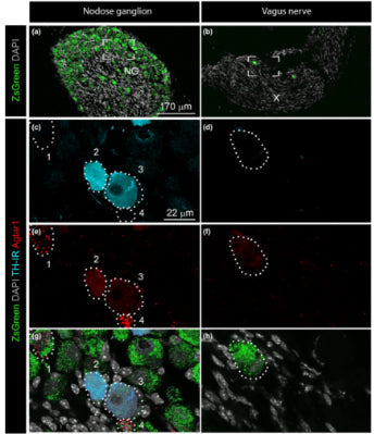 Fluorescent Immunohistochemistry and RNAscope in situ hybridization was performed on samples from Phox2b‐Cre‐ZsGreen mice to visualize the presence if TH (1:2000) and Agtar1 mRNA respectively. (a, c, e, g) Immunoreactivity for TH and Agtar1 mRNA expression varied between neurons in the NG (profiles are dotted outlines 1 – 4). (b, d, f, h) Neither marker was detected in extraganglionic neurons in the vagus nerve (dotted outline). CC-BY-4.0. PMID:37403978